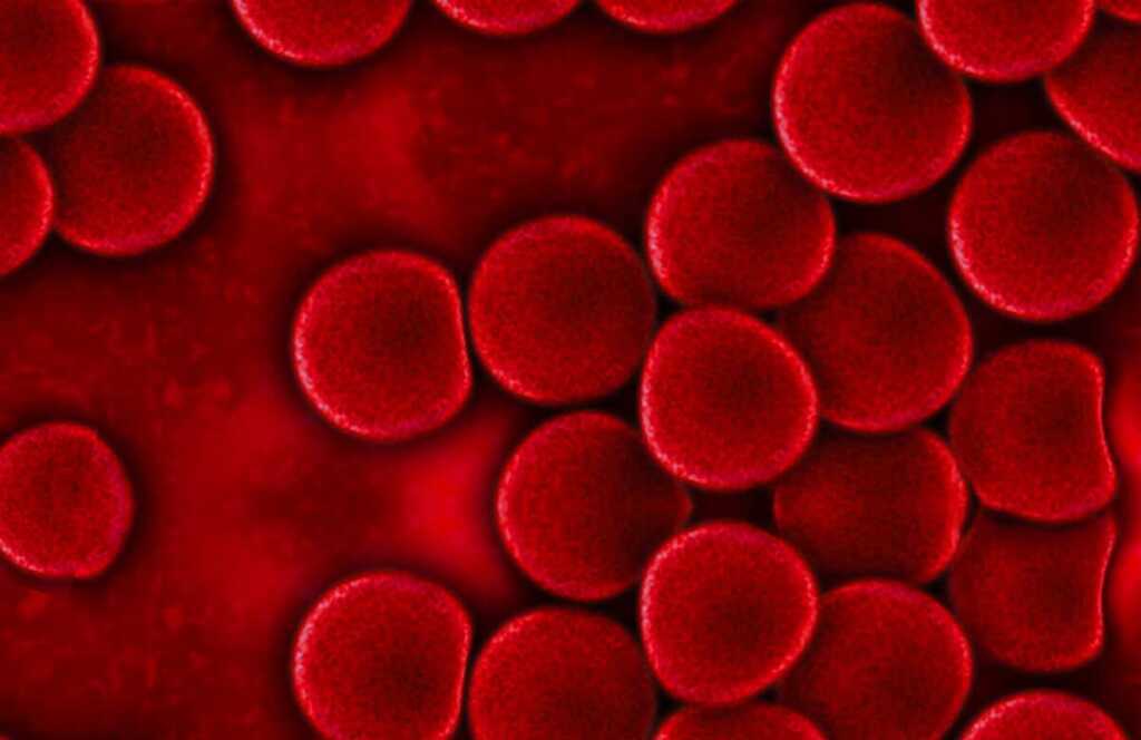 Leukemia