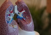 US FDA Approved Datopotamab Deruxtecan as first TROP2 Directed Therapy for Patients with Previously Treated Advanced EGFR-Mutated Non-Small Cell Lung Cancer
